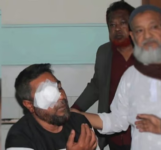 বিএনপির সভাপতি মাসুদ রানা ওরফে মজিদের চোখ গুরুতর জখম হয়েছে। আজ মঙ্গলবার বগুড়ার শহীদ জিয়াউর রহমান মেডিকেল কলেজ হাসপাতালে